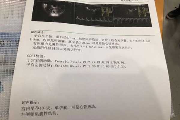 怀孕40天香港验血阴性,试管婴儿胚胎移植后HCG水平低，怎么提高？
