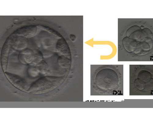 香港验血报告多久官网上可以查询_去香港验血是男孩准吗_验血查男女真的很准