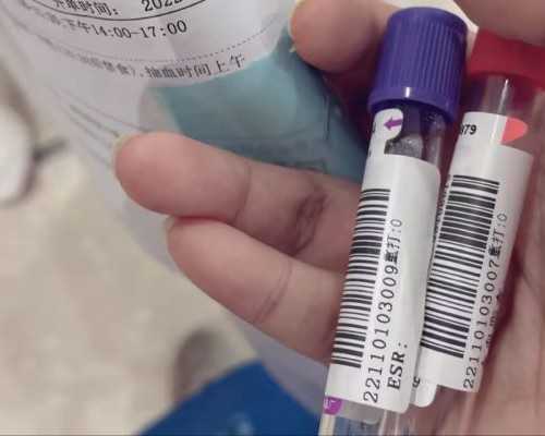 西安私人收购古玩_快手咖喱鱼蛋