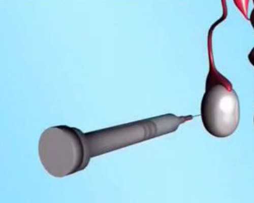 怀孕到香港验血什么时候可以验_香港验血两胎都是女宝准不准_验血查男女是真