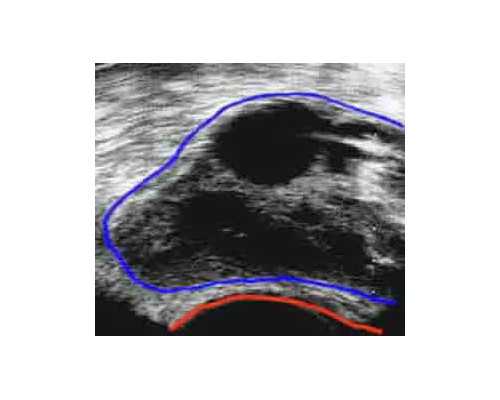 香港验血邮寄得多少钱_香港验血要几天才能有结果_验血查性别,实例分享!