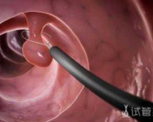 香港验血的中介可靠吗_香港验血9周可以测男女,中介验血是不是真的靠谱