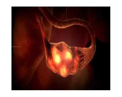 怀孕10周能香港验血吗_香港验血医院流程？想知道准不准关键的都在这！