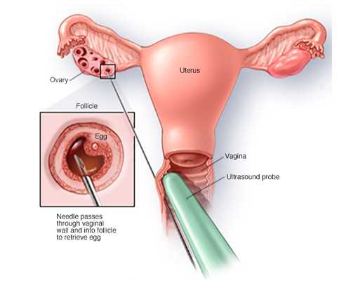 7周香港验血需要空腹吗_香港性别鉴定多少钱,性别鉴定真会翻盘吗