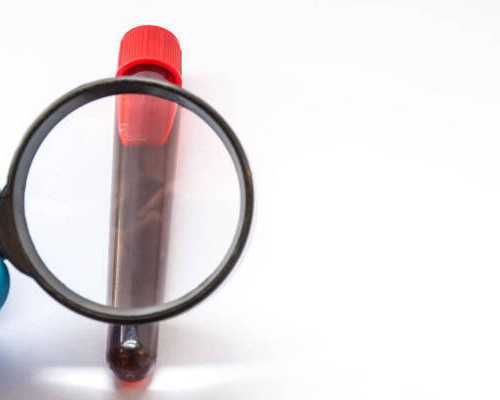 寄血到香港验血靠谱吗 亲身经历告诉你真相_你懂我吗?是什么意思求一首诗,