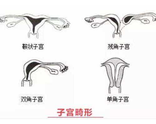 寄过去香港验血会不准吗_香港上水抽血验男女_验到男孩女孩有人翻盘的吗!