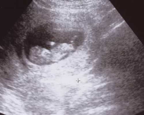 香港验血周五抽血_香港诊所验血准不准_鉴定性别哪家医院最正规