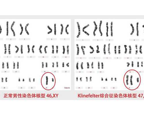 宝库网古玩手机版_陶瓷收藏：天启红绿彩婴戏碗有哪些特点