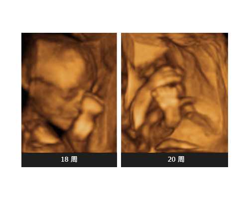 怀孕香港验血多少钱_香港验血有翻盘的吗？挑选正规组织很重要