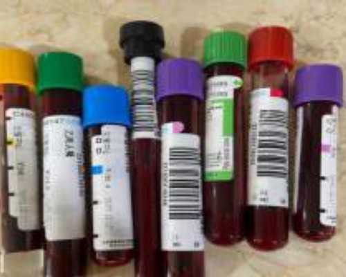 怀孕去香港 验血查男女_香港验血居然翻盘_准确率超级高!