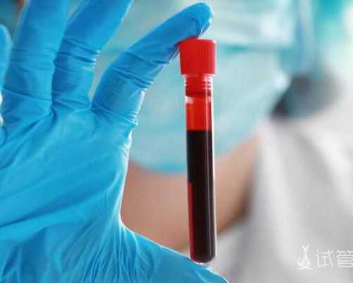 香港验血的血样可以保存多少天_香港查血验男女要多少钱_没想到这么火！