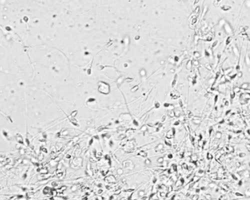 香港验血测胎儿性别有不准的吗_香港有哪些医院能验血查男女_邮寄验血准不准