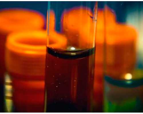 香港验血查男女的机构_香港验血报告有y是男还是女孩_验血查性别哪个验机构准