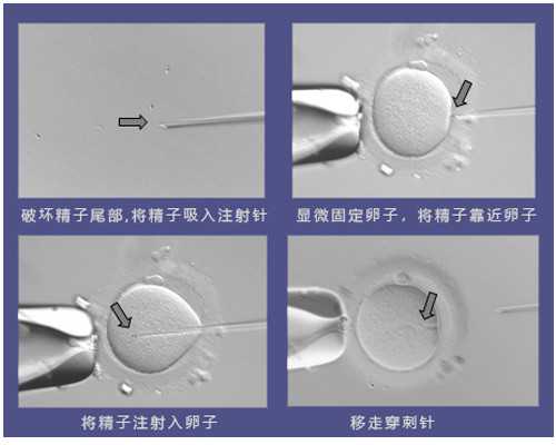 古玩批发市场在哪里_Number 1A