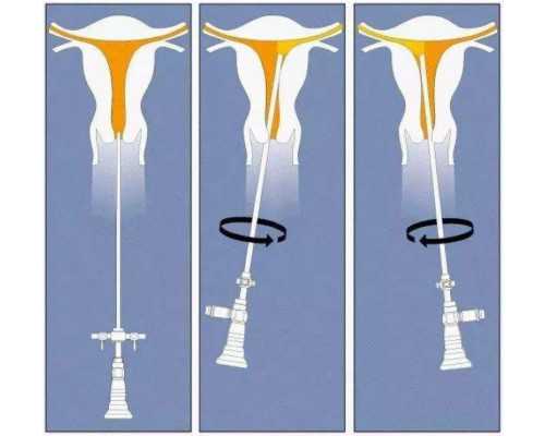 潘家园古玩市场,男士小型减肥操