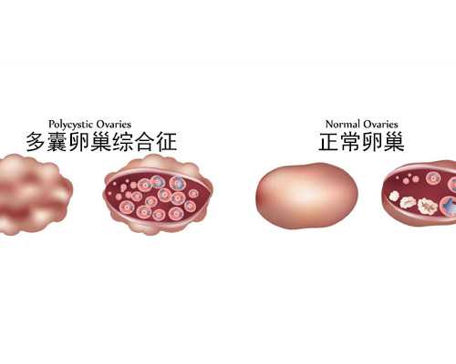 香港7周验血查性别准吗,香港验血检查胎儿性别时间是多久？想知道的凑过来看