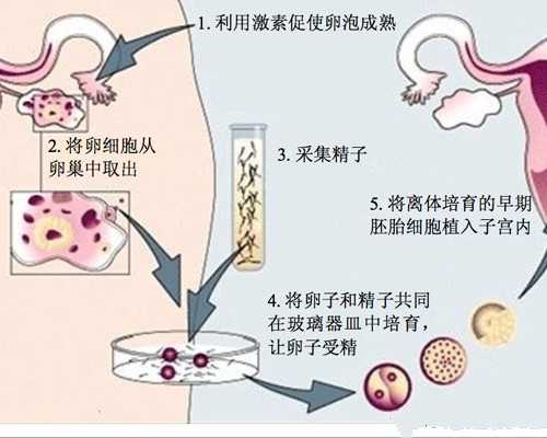 去香港验血几周能验出性别,台湾做试管婴儿要结婚证吗？台湾试管婴儿可以选