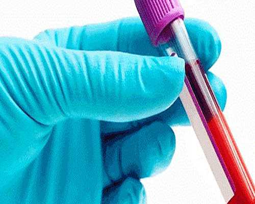 验血邮寄到香港可靠吗裙,做美国试管婴儿二胎肚子快速变大的解释