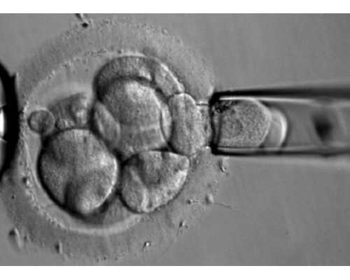 香港验血14个d是男孩,2022年国内不孕不育的治疗费用会纳入医保吗？