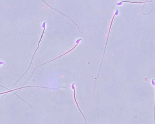 六周去香港验血准吗,自然怀孕多次胎停，赴美做试管婴儿还会发生吗？