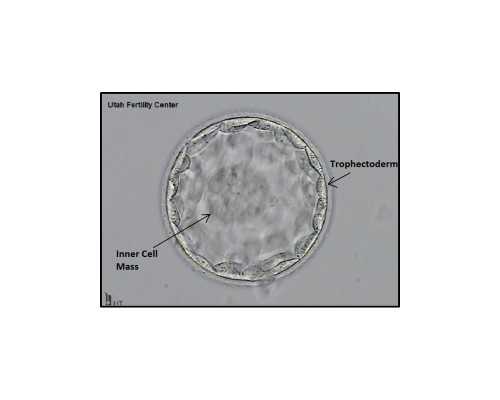 怀孕一个月验血精湛香港卓信,孕酮低怎么备孕？备孕期孕酮低怎么办？