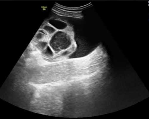 全国最大的古玩交易市场在哪里?,女性一到夜里腿就酸