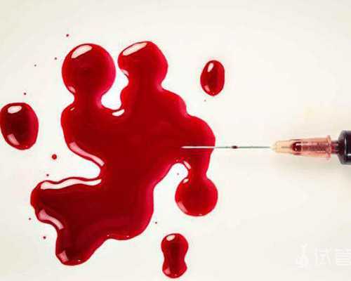 香港验血十三周会不太晚了,在重庆有熟人试管能选男女吗？