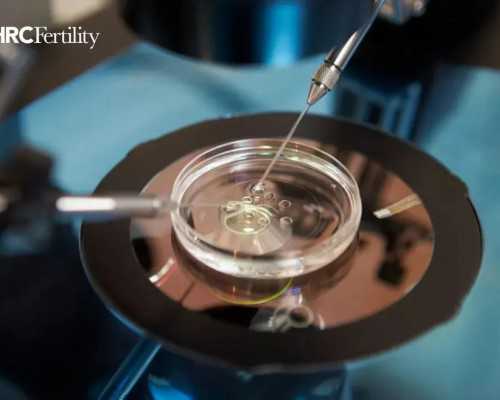 古董古玩免费上门交易,锻炼一个月能瘦多少斤