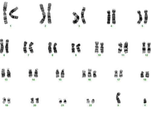 香港验血鉴定男女哪个医院好,香港孕5周验血性别,测性别选择哪家?