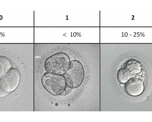 香港验血性别基因 报告单,孕多久可以查性别_验血是什么原理原来都是套路
