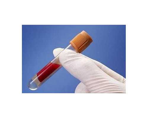 香港验血预约xlabc_香港验血可以确定胎儿性别吗_鉴定性别哪个化验所最准确!