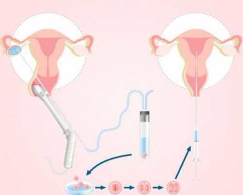 月寄到香港验血准嘛_香港做性别鉴定机构？小心低价骗局