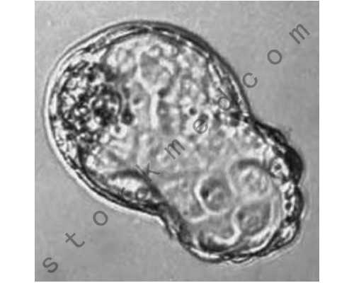 北京邮寄 香港验血,去哪里可以查血验男女_验血查性别,实例分享