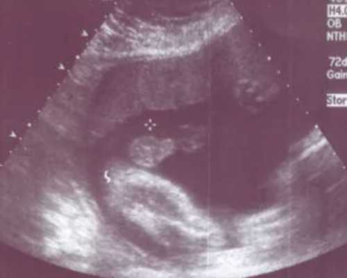 合肥三代试管机构怎么选！合肥三代试管大概费用！