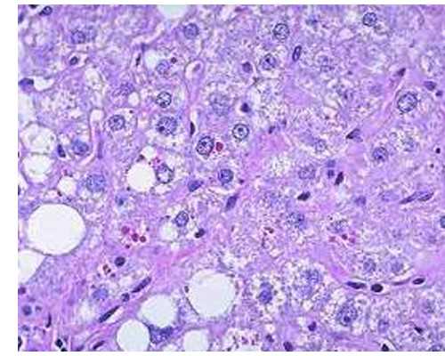 香港化验血看男女准吗,卵泡期是月经期吗