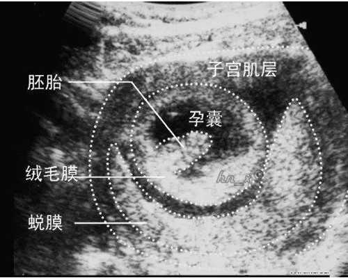 正规香港验血诊所,试管婴儿：看完这篇文章后，你还会选择养囊吗?