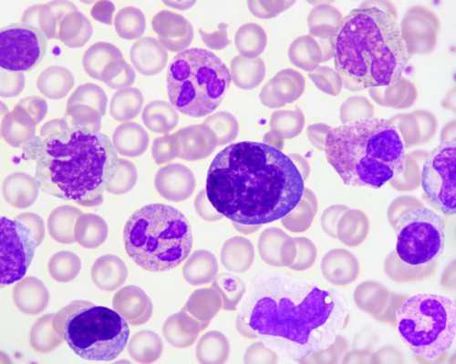 香港验血 假中介_香港验血怎么看化验单,验血查男女哪家最准