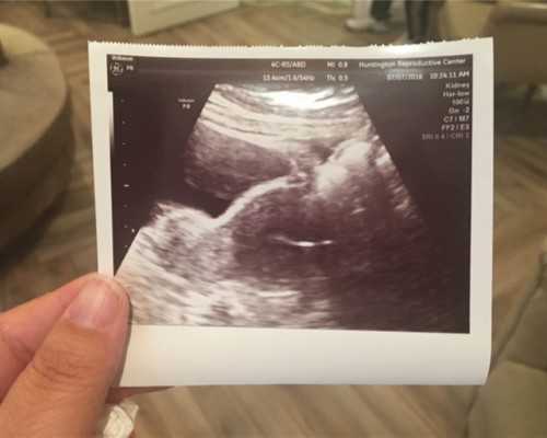 香港验血的费用是多少_怀孕49天可以香港验血吗_香港验血需要几天时间