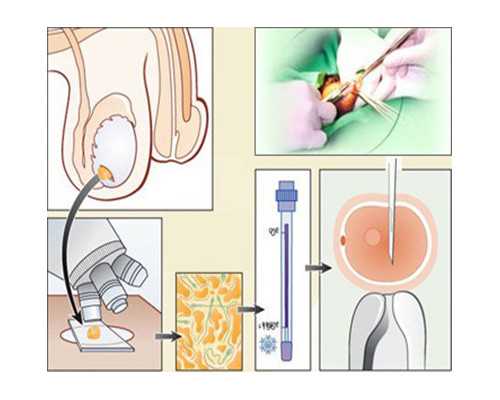 孕44天可以香港验血吗,香港查男女x跟y_多少周可以去香港验血