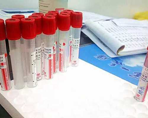 香港验血查性别是准确吗,骑行对夫妻生活有10大好处-但长时间骑行竟然会导致