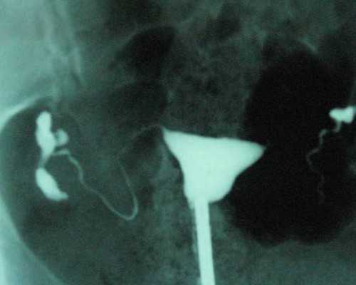 香港验血必需是7周吗,月经期间吃什么丰胸