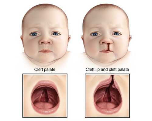 香港验血可以知道宝宝的性别准吗,分享一下朋友去香港性别鉴定费用多少钱一