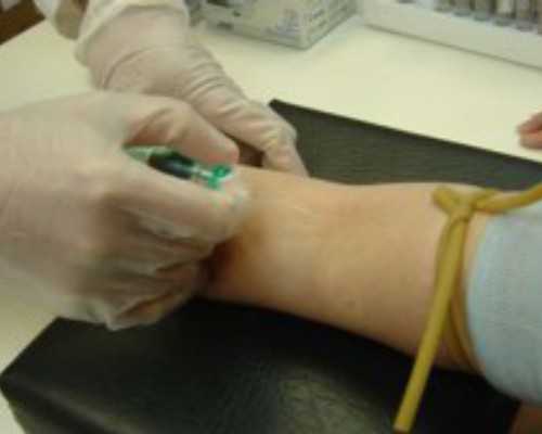 香港验血有哪些机构刀,香港一滴血验性别一般多少钱？千万别错过的最全性别