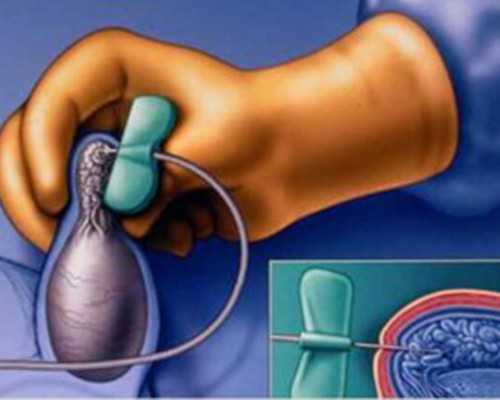 香港验血报告为什么不邮寄_一篇关于春游的作文春游作文500字