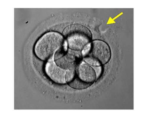去香港验血性别出丫男孩准吗,美国试管婴儿取卵过程使用麻药会对卵子或身体