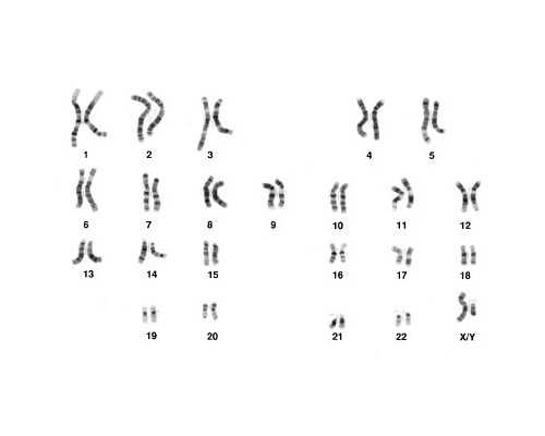 香港验血男女费用要多少,香港化验血男孩女孩准吗_验血查性别哪家最准