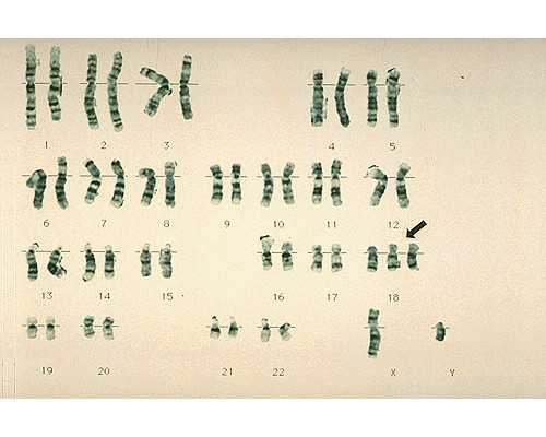 怀孕一个月去香港验血准吗_香港黄伟忠验血准吗_真实感受与经历