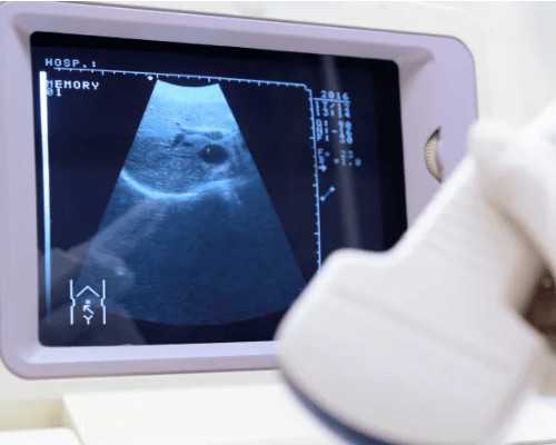 厦门寄香港验血的好多,香港抽血验性别要多少钱最详细的攻略-内地去香港8周查