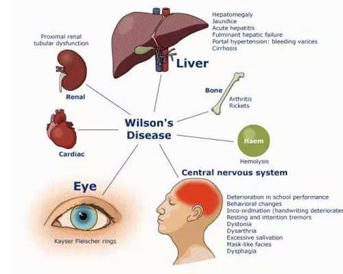 高局长古玩骗局,移植冻胚后注意事项