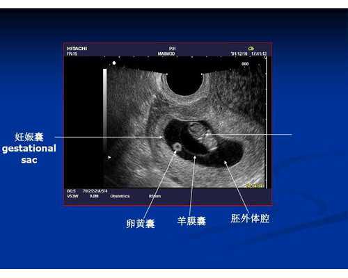 香港验血胎儿多少钱,香港测血查性别中介_邮寄验血准不准!